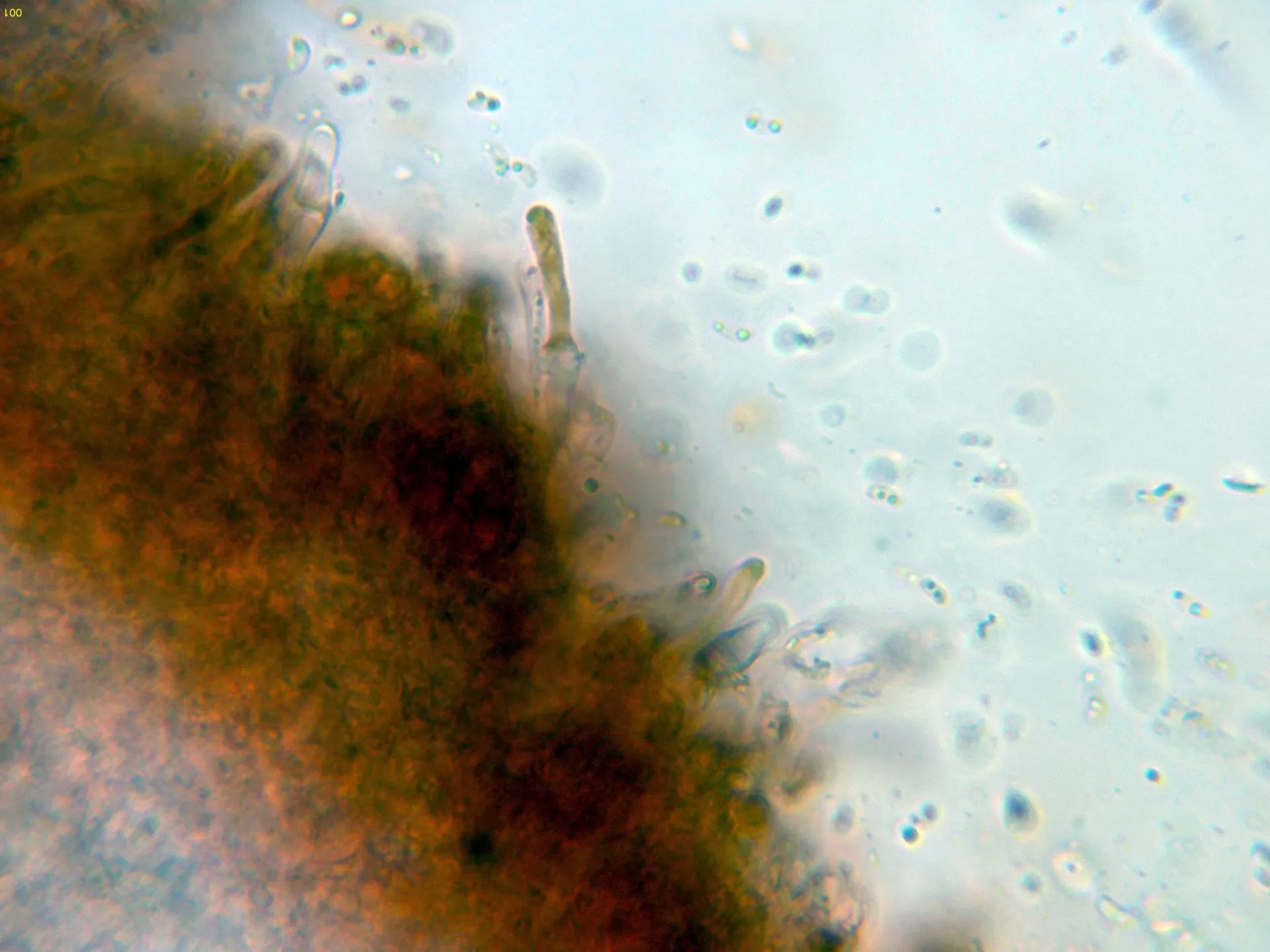 Microscopía de Phlebia tremellosa - 10 - Cistidio-001